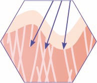 C-Skin-phase-1