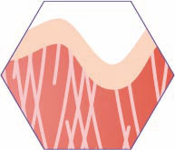 C-Skin-phase-2